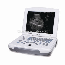 DW500 12 pulgadas pantalla LED barato hospital doctor médico uso portátil ultrasónico máquina y computadora portátil máquina ultrasónica